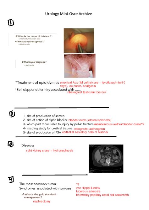 مسالك - Summary - Organizational behavior - *Treatment of epididymitis *Bell clapper deformity ...