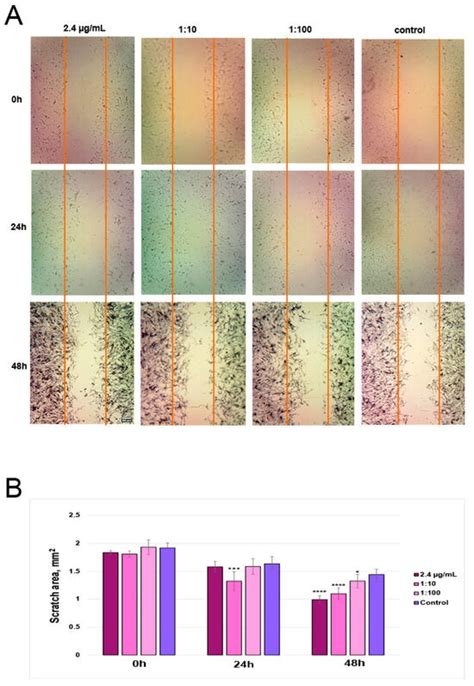 Halochromic Bacterial Cellulose/Anthocyanins Hybrid Polymer Film with ...