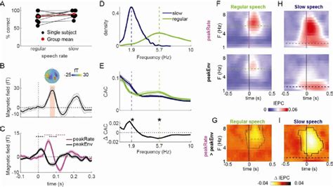Image result for Phase Locking Auditory System