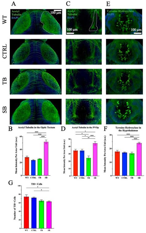 CPT2 Deficiency Modeled in Zebrafish: Abnormal Neural Development ...