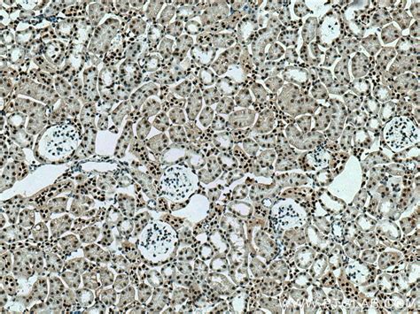 SMARCA4/BRG1 antibody (21634-1-AP) | Proteintech