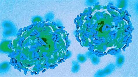 Megasphaera Type 1 | PULSE CLINIC - Asia's Leading Sexual Healthcare ...