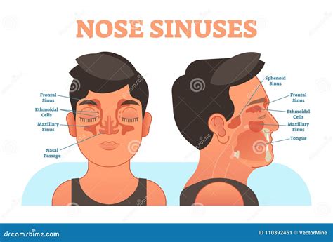 Nose Sinuses Anatomical Vector Illustration Cross Section. Stock Vector - Illustration of nasal ... - illustration of sinuses