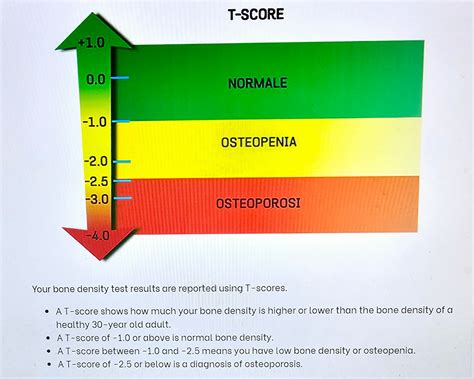 YES! You can you reverse your T-Score... Normal... Osteopenia... Osteoporosi - Supplements ...