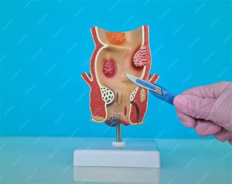Premium Photo | Doctor is holding scalpel anatomy of rectum problem - anatomy of rectum