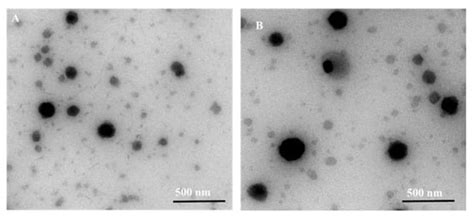 Recent Progress in Chitosan-Based Nanomedicine for Its Ocular ...