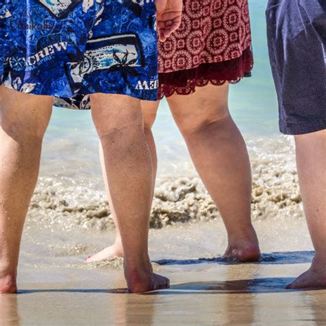 Obesity and Skin Health | Clinikally