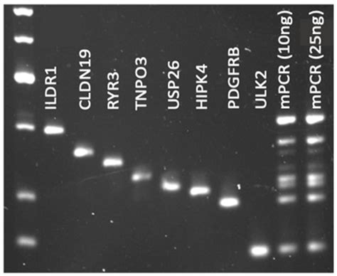 Investigating the Use of Circulating Tumor DNA for Sarcoma Management