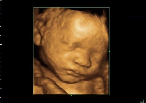 31 weeks Baby in 3D 4D scan Ultrasound | 31 weeks baby image… | Flickr