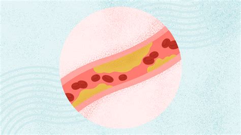 Lipid Panel: What It Is and Why You Need to Fast Beforehand