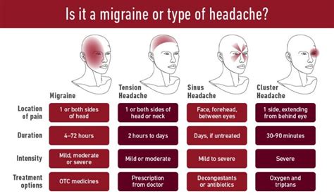 migraine headache