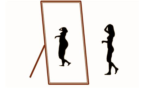 Anorexia nervosa linked to stunted linear growth among young women