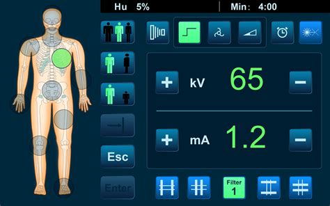 Smart AEC in Medical Imaging: The “Brain” Behind Every Clear Image – PerLove
