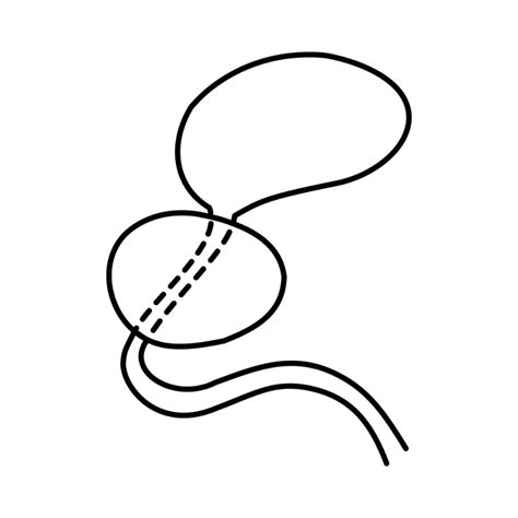 Prostate Radiation Simulation 的图像结果