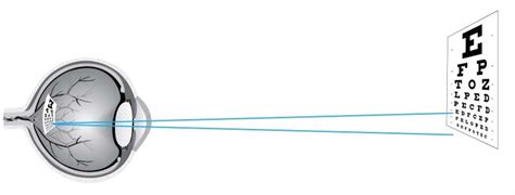 Image result for Eye Visual Acuity