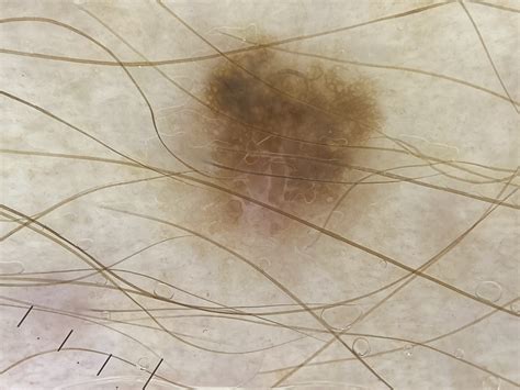 W poniedziałek 11.12.2024 w Kamiennej Górze odbyły się badania profilaktyczne! - Old Town ...