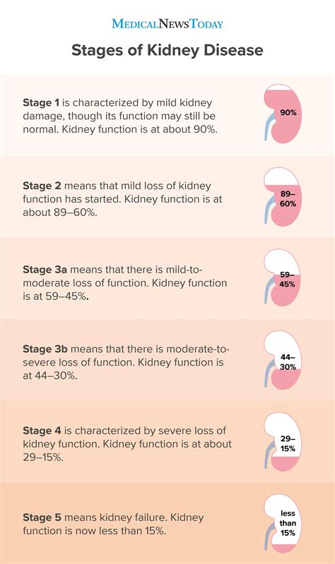 Kidney failure – Artofit