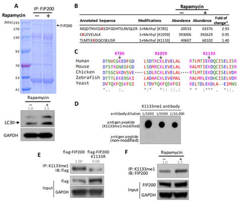 FIP200 Methylation by SETD2 Prevents Trim21-Induced Degradation and ...