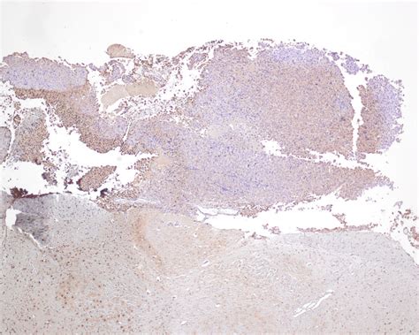 Image result for Poor IHC Staining