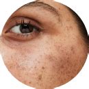 Tranexamic Acid Face Serum – Be Me