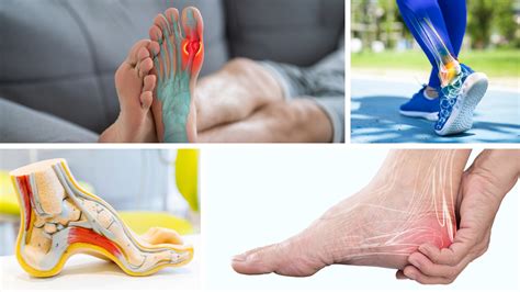 Foot Anatomy Pain Plantar Fasciitis — Why Do My Heels Hurt?