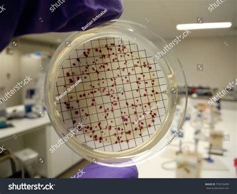 Image result for Colony-Forming Unit Definition