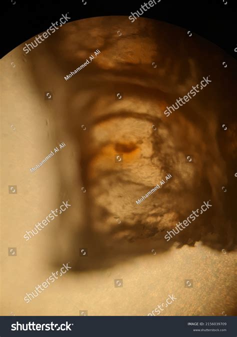 Image result for Microscope Toes