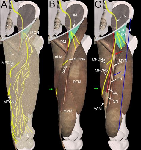 Anesthesia of the anterior femoral cutaneous nerves for total knee arthroplasty incision ...