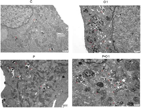 Oxycodone enhances antitumor effect of paclitaxel on human breast cancer SKBR3 cells in vitro ...