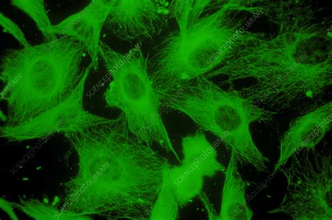 Cell microtubules/cytoskeleton - Stock Image - G470/0002 - Science Photo Library