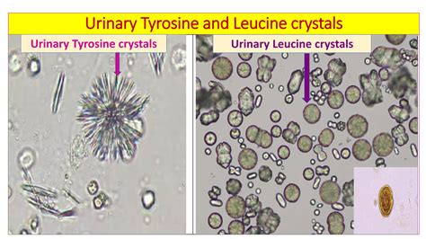 Microscopic examination of urine