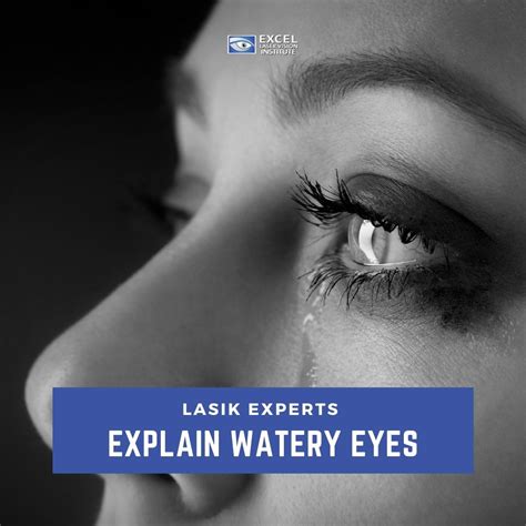 Medical Terminology Of Watery Eye at Ruth Townsend blog