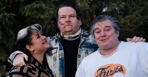 After Rare Surgery, This 22-Year-Old Man Has A New Face And Pair Of Hands