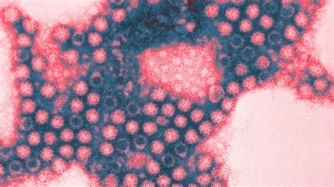 Image result for Pathogen of Humans