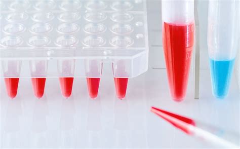 Understanding the Sedimentation Rate: Importance and Interpretation ...