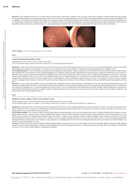 Image result for Perforated Appendix