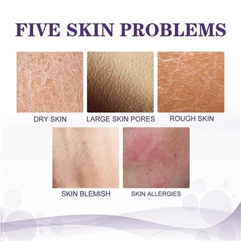 Keratosis Pilaris Repair Cream Exfoliating For India | Ubuy