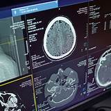 CT-Scans als Treiber für Strahlenbelastung - - Universimed - Knowledge ...