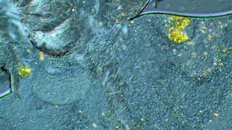 Image result for Spring Tails Bugs Under Microscope