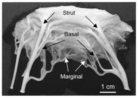 New Insights on the Formation of the Mitral Valve Chordae Tendineae in ...
