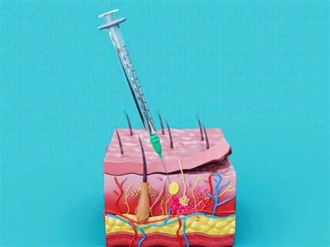 Fascia and interstitium's role in health and movement | Meer