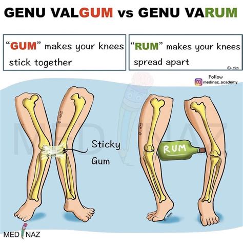 Q Angle Genu Valgum Anatomy of Anterior thigh