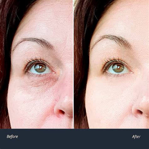 Baggy Eyes How To Reduce Puffy Eyes | SheerLuxe