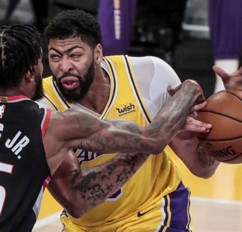 Anthony Davis Teeth Problem