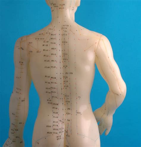 Acupuncture 的图像结果