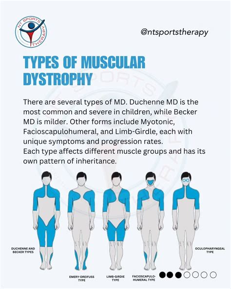 NTsportstherapy on Instagram: "Muscular Dystrophy is a group of genetic conditions that cause ...