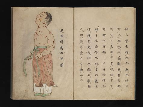 Smallpox Scabs