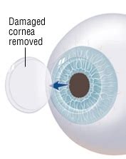 DR. SAYAN DAS : Best Eye Surgeon Saltlake, Phoolbagan, Kaikhali, Best ...