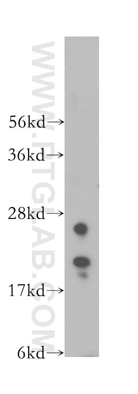 IMP3 antibody (12750-1-AP) | Proteintech