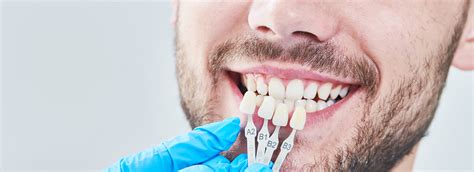 Dental Veneers in Hyderabad - Transform Your Smile at Dermadent Dental ...